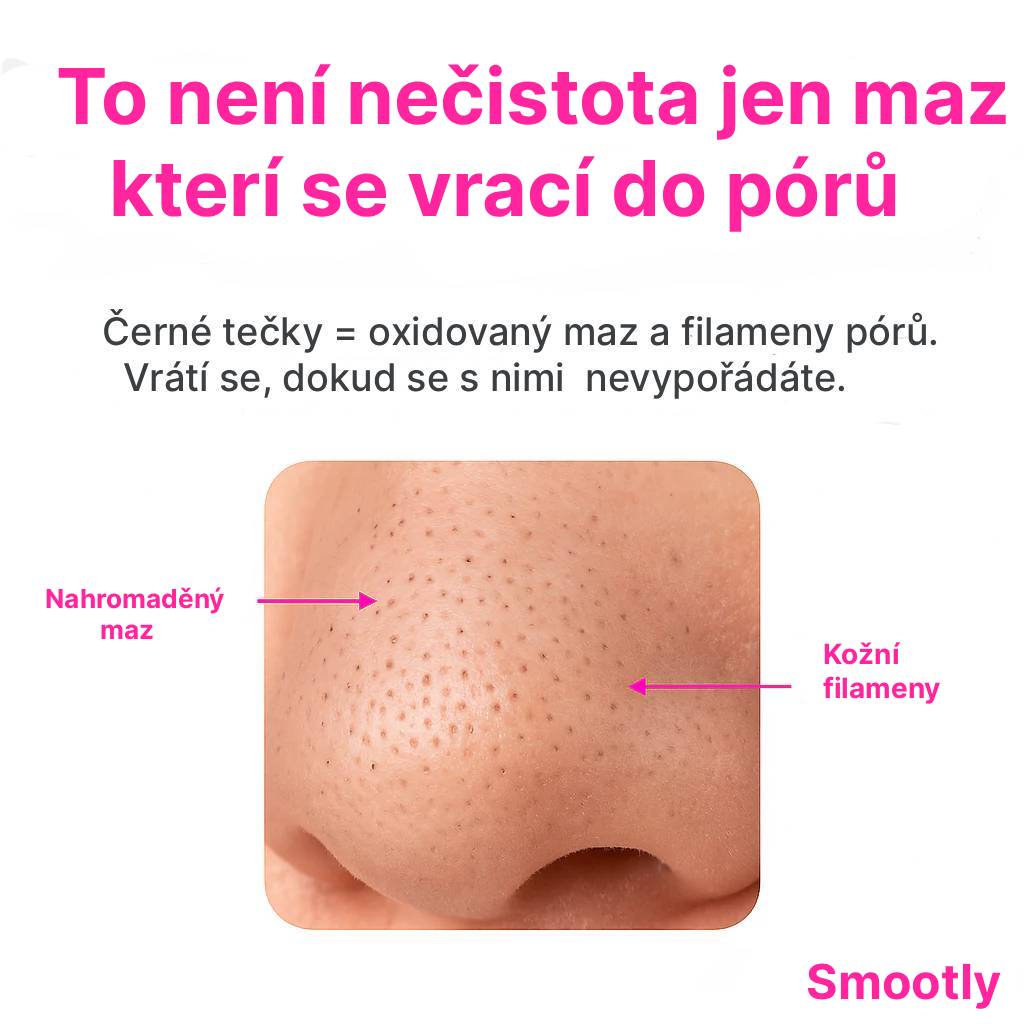 Smootly: Automaticky Vysavač Pórů