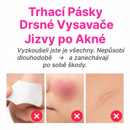 Smootly: Automaticky Vysavač Pórů