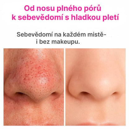 Smootly: Automaticky Vysavač Pórů